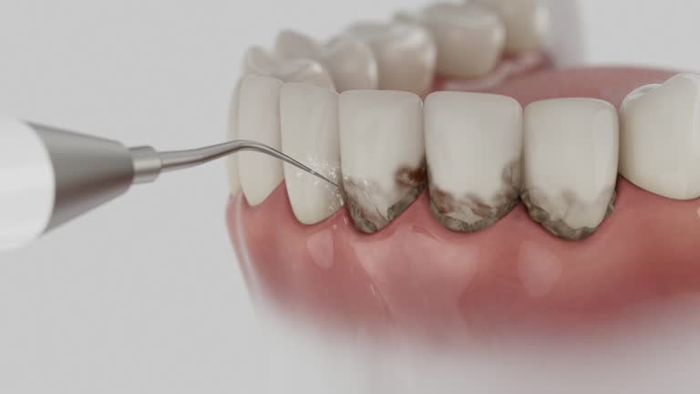 Reliable Emergency Dentist contractor in Staples, MN by Smile Center Dentistry